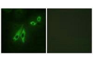 Immunofluorescence analysis of NIH/3T3 cells, using AKAP3 antibody. (AKAP3 anticorps)