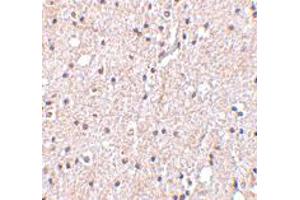 Immunohistochemistry of BRSK2 in human brain tissue with BRSK2 polyclonal antibody  at 5 ug/mL . (BRSK2 anticorps  (C-Term))