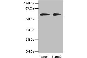 Western blot All lanes: ZNF529 antibody at 6 μg/mL Lane 1: Hela whole cell lysate Lane 2: MCF-7 whole cell lysate Secondary Goat polyclonal to rabbit IgG at 1/10000 dilution Predicted band size: 66 kDa Observed band size: 66 kDa (ZNF529 anticorps  (AA 393-563))