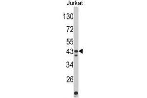 Western blot analysis of CECR5 Antibody (Center) in Jurkat cell line lysates (35ug/lane).