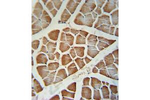 CYP2J2 Antibody (Center) (ABIN391655 and ABIN2841565) immunohistochemistry analysis in formalin fixed and paraffin embedded human skeletal muscle followed by peroxidase conjugation of the secondary antibody and DAB staining.
