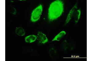 Immunofluorescence of monoclonal antibody to ARHGEF1 on HeLa cell.