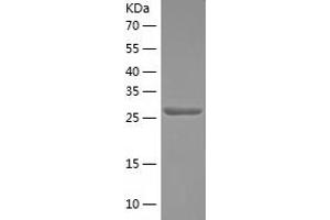 Western Blotting (WB) image for Syntaxin 1A (Brain) (STX1A) (AA 1-265) protein (His tag) (ABIN7125291)