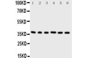 Western Blotting (WB) image for anti-Cyclin-Dependent Kinase 7 (CDK7) (AA 329-346), (C-Term) antibody (ABIN3042892) (CDK7 anticorps  (C-Term))