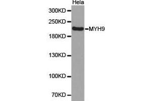 Western Blotting (WB) image for anti-Myosin 9 (MYH9) antibody (ABIN1873802) (Myosin 9 anticorps)