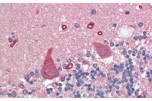 Detection of AGRN in Human Cerebellum Tissue using Polyclonal Antibody to Agrin (AGRN)