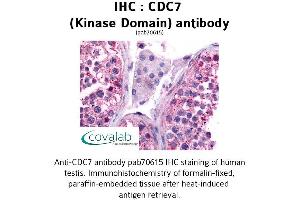 Image no. 1 for anti-Cell Division Cycle 7 (CDC7) antibody (ABIN1732913)