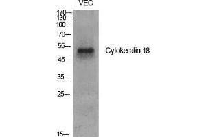 Western Blot (WB) analysis of specific cells using Cytokeratin 18 Polyclonal Antibody. (Cytokeratin 18 anticorps  (Ser726, Ser731))
