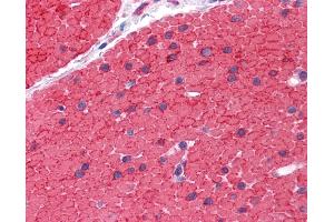 Anti-LDLRAP1 antibody IHC of human small intestine, muscularis propria.