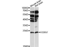 Western blot analysis of extracts of various cell lines, using HOX antibody (ABIN6128063, ABIN6141940, ABIN6141941 and ABIN6216689) at 1:3000 dilution. (HOXA7 anticorps  (AA 1-120))