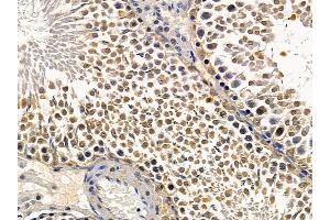 ABIN6266003 and ABIN6278719 at 1/100 staining rat testis tissue by IHC-P.