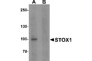 Western blot analysis of STOX1 in human liver tissue lysate with STOX1 antibody at 1 µg/mL in (A) the absence and (B) the presence of blocking peptide. (STOX1 anticorps  (C-Term))