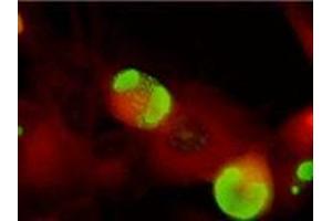 Immunofluorescence (IF) image for anti-ICP36 DNA Binding Protein (CMV ICP36) antibody (ABIN265543) (ICP36 DNA Binding Protein (CMV ICP36) anticorps)