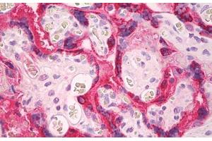 anti-CGA / hCG alpha antibody