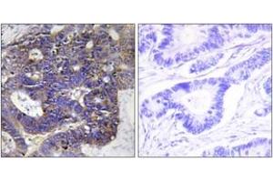 Immunohistochemistry (IHC) image for anti-Collagen, Type IV, alpha 2 (COL4A2) (AA 151-200) antibody (ABIN2889911) (COL4a2 anticorps  (AA 151-200))