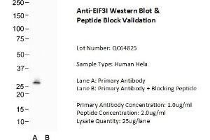 Host: Rabbit Target Name: EIF3I Sample Type: Human Hela  Lane A: Primary Antibody  Lane B: Primary Antibody + Blocking Peptide  Primary Antibody Concentration: 1. (EIF3I anticorps  (Middle Region))