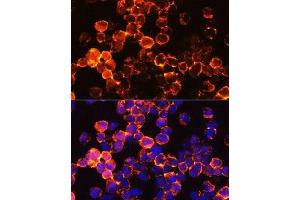 Immunofluorescence analysis of Jurkat cells using CD45 Rabbit pAb (ABIN6130077, ABIN6146454, ABIN6146456 and ABIN6213826) at dilution of 1:100.