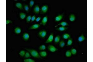 Immunofluorescent analysis of A549 cells using ABIN7166191 at dilution of 1:100 and Alexa Fluor 488-congugated AffiniPure Goat Anti-Rabbit IgG(H+L)