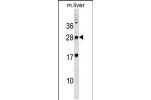 Western blot analysis in mouse liver tissue lysates (35ug/lane). (MPZL3 anticorps  (C-Term))