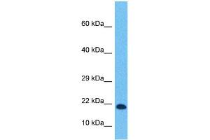 Host:  Rabbit  Target Name:  TCF21  Sample Tissue:  Human Ovary Tumor  Antibody Dilution:  1ug/ml