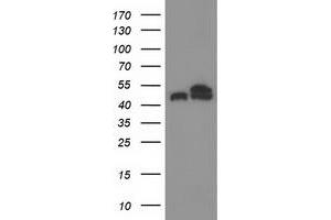 Western Blotting (WB) image for anti-Tubulin beta 4a (TUBB4A) antibody (ABIN1501579) (TUBB4 anticorps)