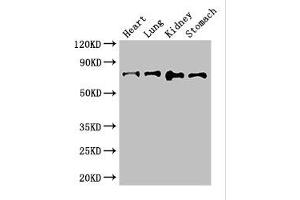 Western Blot Positive WB detected in: Mouse heart tissue, Mouse lung tissue, Mouse kidney tissue, Mouse stomach tissue All lanes: ABCG8 antibody at 2. (ABCG8 anticorps  (AA 176-413))