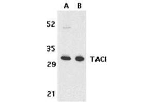 Western blot analysis of TACI in K562 (A) and U937 (B) cell lysates with this product at 5 μg/ml. (TACI anticorps  (N-Term))