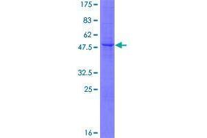 Image no. 1 for Glycosylphosphatidylinositol Anchored High Density Lipoprotein Binding Protein 1 (GPIHBP1) (AA 1-184) protein (GST tag) (ABIN1355546)