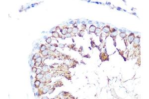 Immunohistochemistry of paraffin-embedded rat testis using Folate Binding Protein(FBP) / FOLR1 Rabbit pAb (ABIN7267224) at dilution of 1:100 (40x lens).