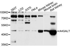 Western blot analysis of extracts of various cell lines, using A4GALT antibody (ABIN5995923) at 1/1000 dilution. (A4GALT anticorps)