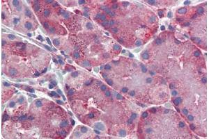 Human, Stomach: Formalin-Fixed Paraffin-Embedded (FFPE) (ERP44 anticorps  (C-Term))