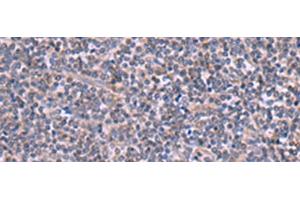 Immunohistochemistry of paraffin-embedded Human tonsil tissue using RIC3 Polyclonal Antibody at dilution of 1:90(x200) (RIC3 anticorps)