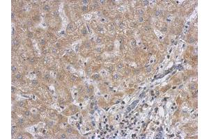 anti-Rac GTPase Activating Protein 1 (RACGAP1) (N-Term) antibody