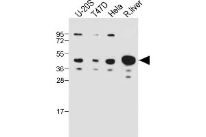 All lanes : Anti-IDAS Antibody (N-term) at 1:1000 dilution Lane 1: U-20S whole cell lysate Lane 2: T47D whole cell lysate Lane 3: Hela whole cell lysate Lane 4: Rat liver whole cell lysate Lysates/proteins at 20 μg per lane.