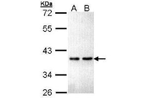 WB Image Sample (30 ug of whole cell lysate) A: Hela B: Hep G2 , 12% SDS PAGE antibody diluted at 1:5000 (ZNF346 anticorps)
