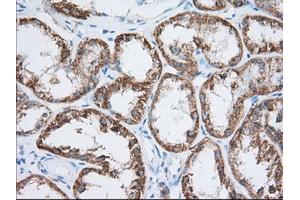 Immunohistochemical staining of paraffin-embedded Human Kidney tissue using anti-HIBCH mouse monoclonal antibody.
