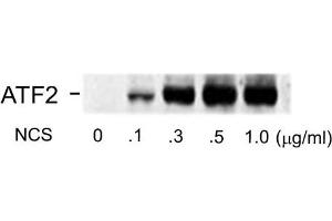 Western blots of human melanoma cells incubated with varying doses of the radiomimetic drug NCS showing specific immuno-labeling of the ~74k ATF2 protein phosphorylated at Ser490 and Ser498.