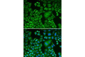 Immunofluorescence analysis of HeLa cells using ACTR3 antibody (ABIN5970423). (ACTR3 anticorps)