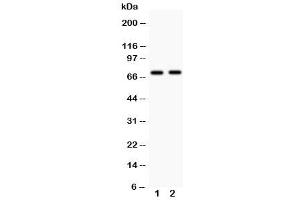 Western blot testing with MEKK3 antibody Lane 1: rat brain (MAP3K3 anticorps  (N-Term))