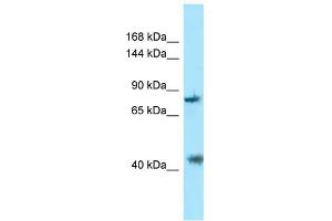 WB Suggested Anti-PACS1 Antibody Titration: 1.