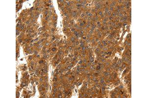 Immunohistochemistry (IHC) image for anti-Sodium Channel, Voltage-Gated, Type XI, alpha Subunit (SCN11A) antibody (ABIN2432261) (SCN11A anticorps)