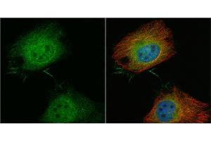 ICC/IF Image T-Plastin antibody detects T-Plastin protein at cytoplasm and nucleus by immunofluorescent analysis.