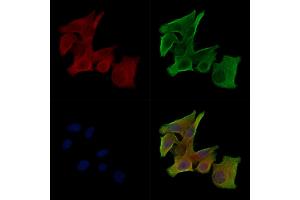 Phospho-RYR2 (Ser2030) Antibody staining HepG2 cells(serum starvation treatment) by IF/ICC. (RYR2 anticorps  (pSer2030))