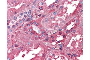 Immunohistochemistry (IHC) image for anti-Albumin (ALB) (N-Term) antibody (ABIN2776969)