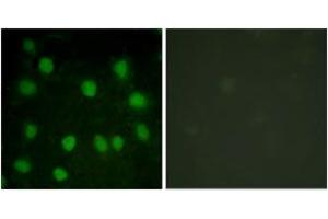 Immunofluorescence analysis of HuvEc cells, using Dematin (Ab-403) Antibody. (Dematin anticorps  (AA 356-405))