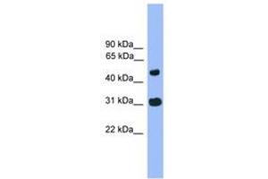 Image no. 1 for anti-Family with Sequence Similarity 13, Member C (FAM13C) (AA 81-130) antibody (ABIN6745285) (FAM13C anticorps  (AA 81-130))