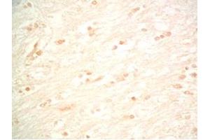 Rat brain tissue was stained by Rabbit Anti-Metasin (1-25) / KISS-1 (68-92) (Human) Serum