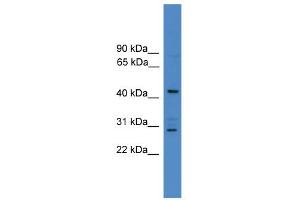 WB Suggested Anti-ARMC8 Antibody Titration: 0. (ARMC8 anticorps  (N-Term))