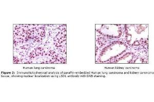 Image no. 1 for anti-Lysine (K)-Specific Demethylase 1A (KDM1A) antibody (ABIN207611) (LSD1 anticorps)