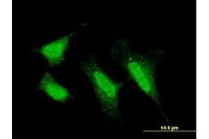 Immunofluorescence of monoclonal antibody to PRKCI on HeLa cell. (PKC iota anticorps  (AA 1-587))